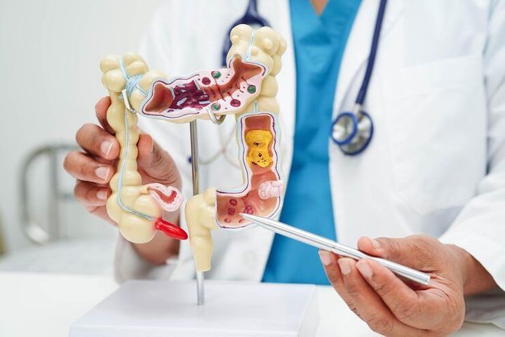 Colon Cancer Screening Guide: Learn Early Detection, Benefits, and Testing Options